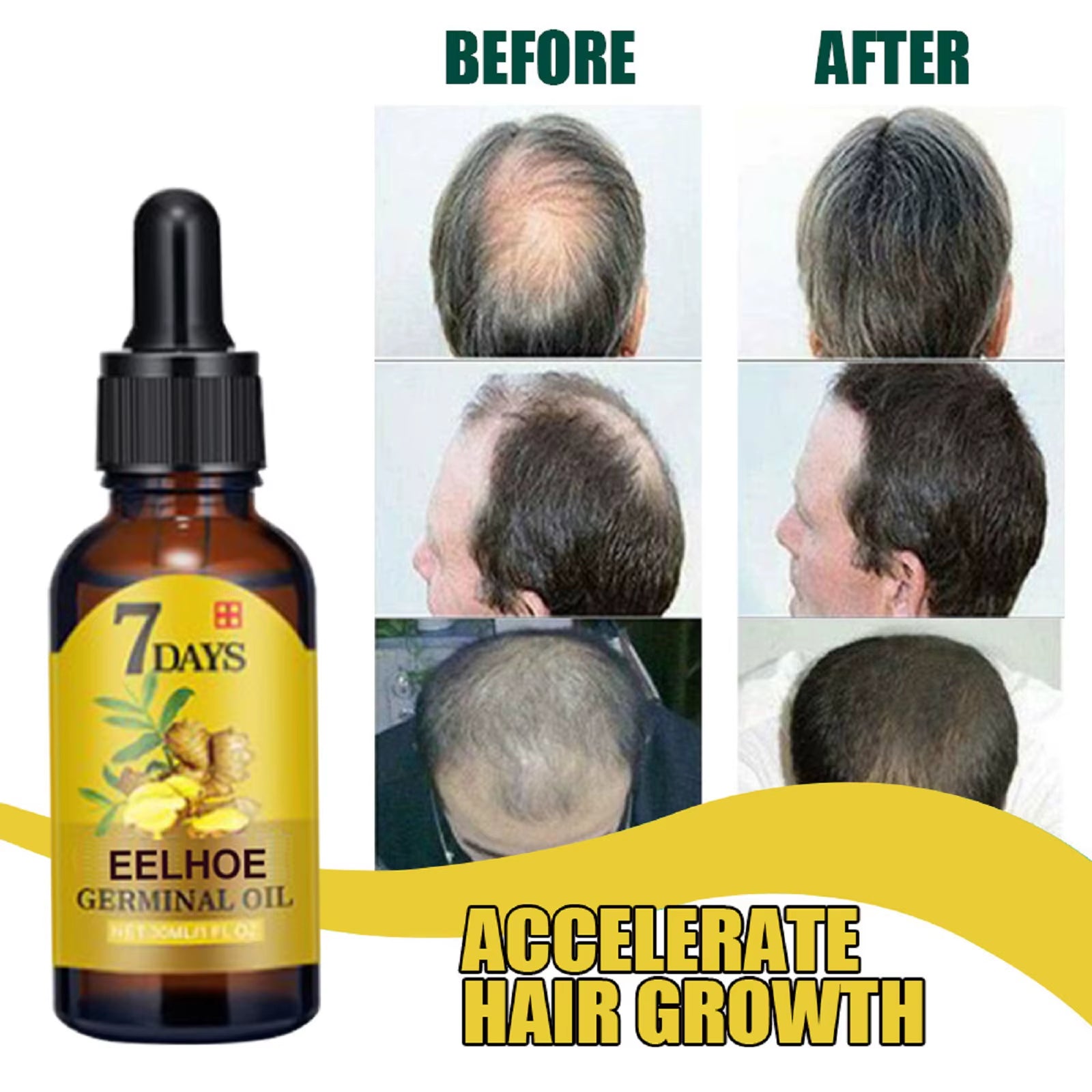 Treatment anti Hair Loss Scalp Treatment Serum Products Strengthen Hair Roots