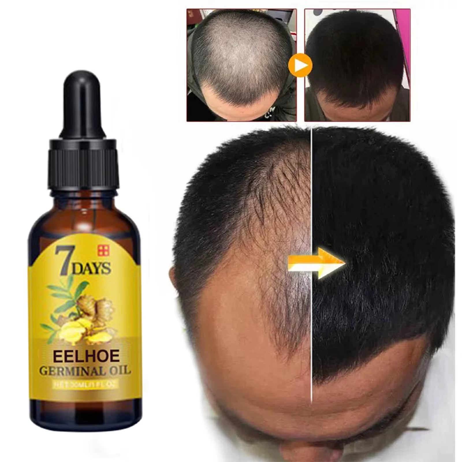 Treatment anti Hair Loss Scalp Treatment Serum Products Strengthen Hair Roots